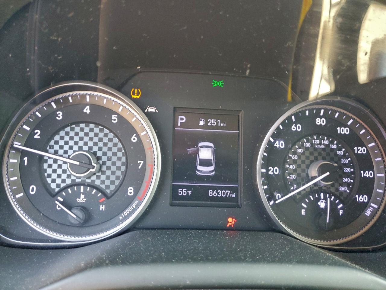 Hyundai ELANTRA Se Image 4